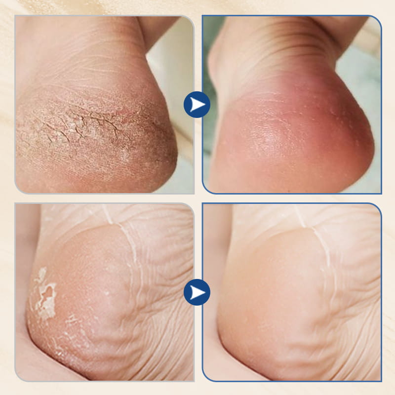 🎉Compra 2 y llévate 1 gratis🎉Crema hidratante y antigrietas para pies