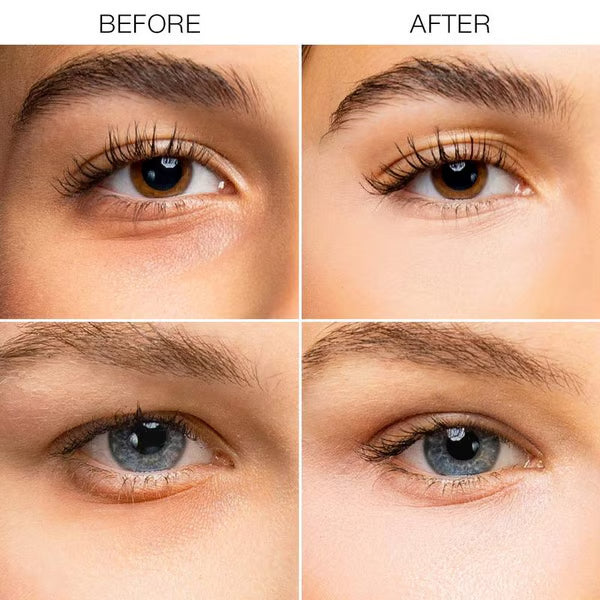 🎁2026 New Arrivals 50% OFF💥Under-Eye Brightener Cream – Dark Circle Correction & Fine Line Smoothing