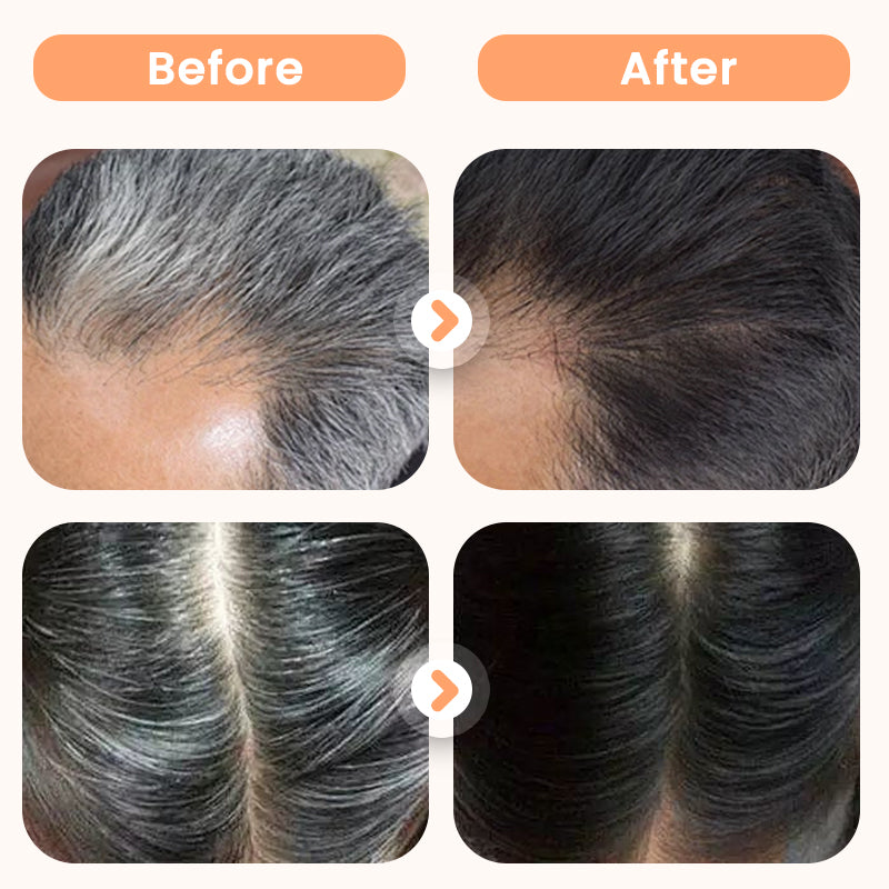 🌿 ¡COMPRA 2 LLEVA 3! ✨ Tinte Capilar con Extractos Vegetales - Cobertura Natural de Canas sin Amoníaco, Aporta Brillo y Suavidad al Cabello 💇‍♀️🧴