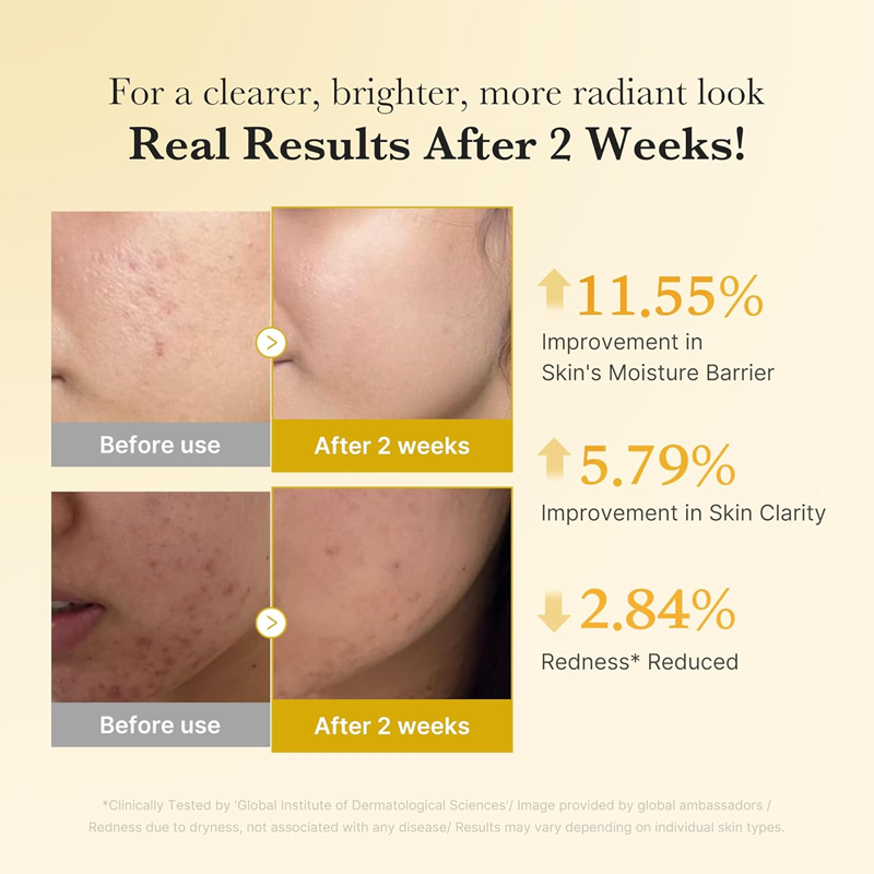 🥳2026 HOT SALE🥳💞50K+ SOLD!💫🌼 50% OFF! Kojic Acid Turmeric Brightening Serum – Fades dark spots, evens tone, soothes redness. Lightweight & gentle for daily use. ✨🌸