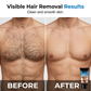 Men's Gentle Hair Removal Cream