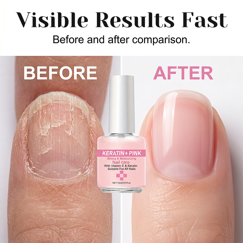 ✨Compra 1 Lleva 2✨Fortalecedor de Uñas con Keratina & Hidratante