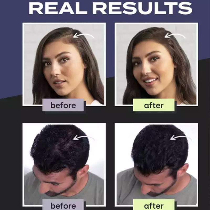 🔥Kit de fibras de construcción del cabello para el adelgazamiento del cabello y calvicie