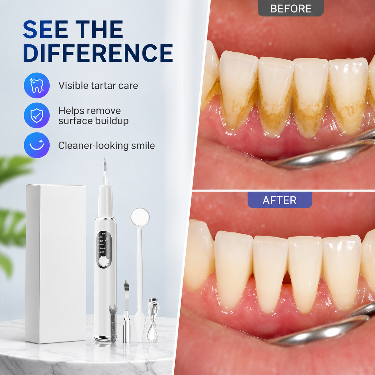 Limpiador dental ultrasónico portátil y kit eliminador de sarro